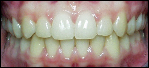 lori-smith-orthodontics_a-good-bite.png