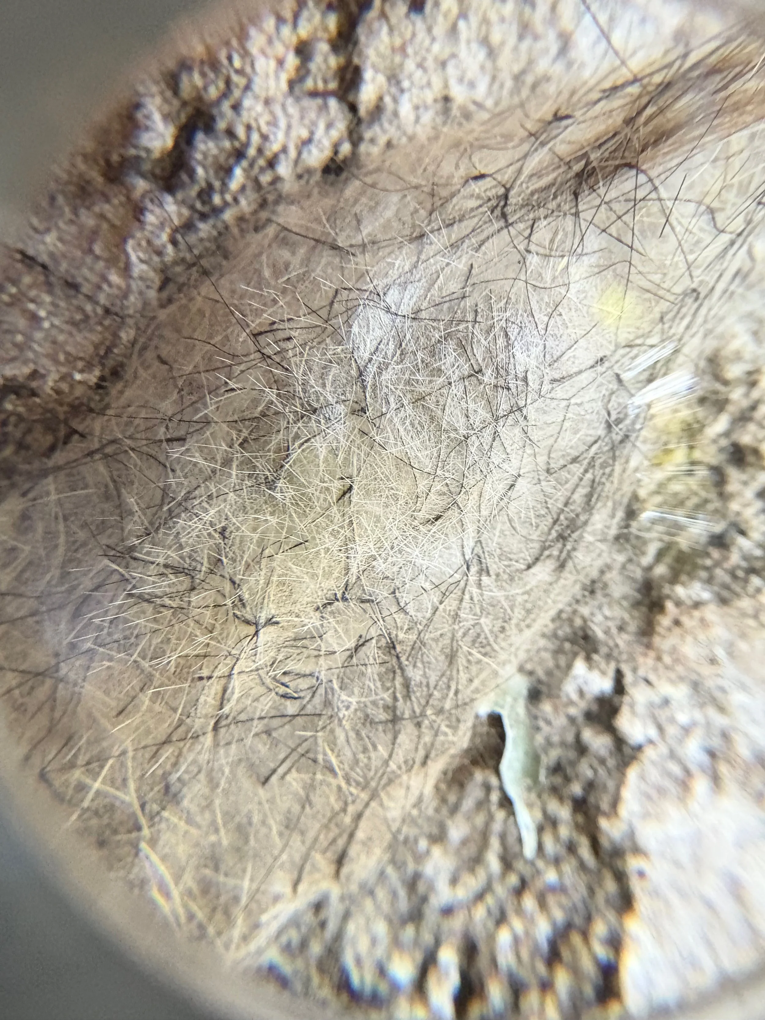  Pupae as seen through lens 