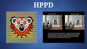 A Review of Hallucinogen Persisting Perception Disorder (HPPD) and an Exploratory Study of Subjects Claiming Symptoms of HPPD