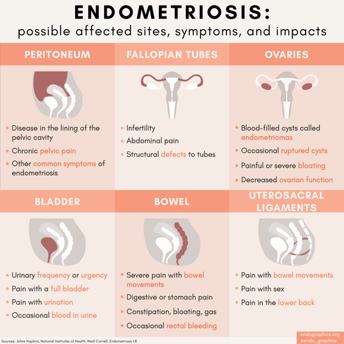 Body sites affected by endometriosis