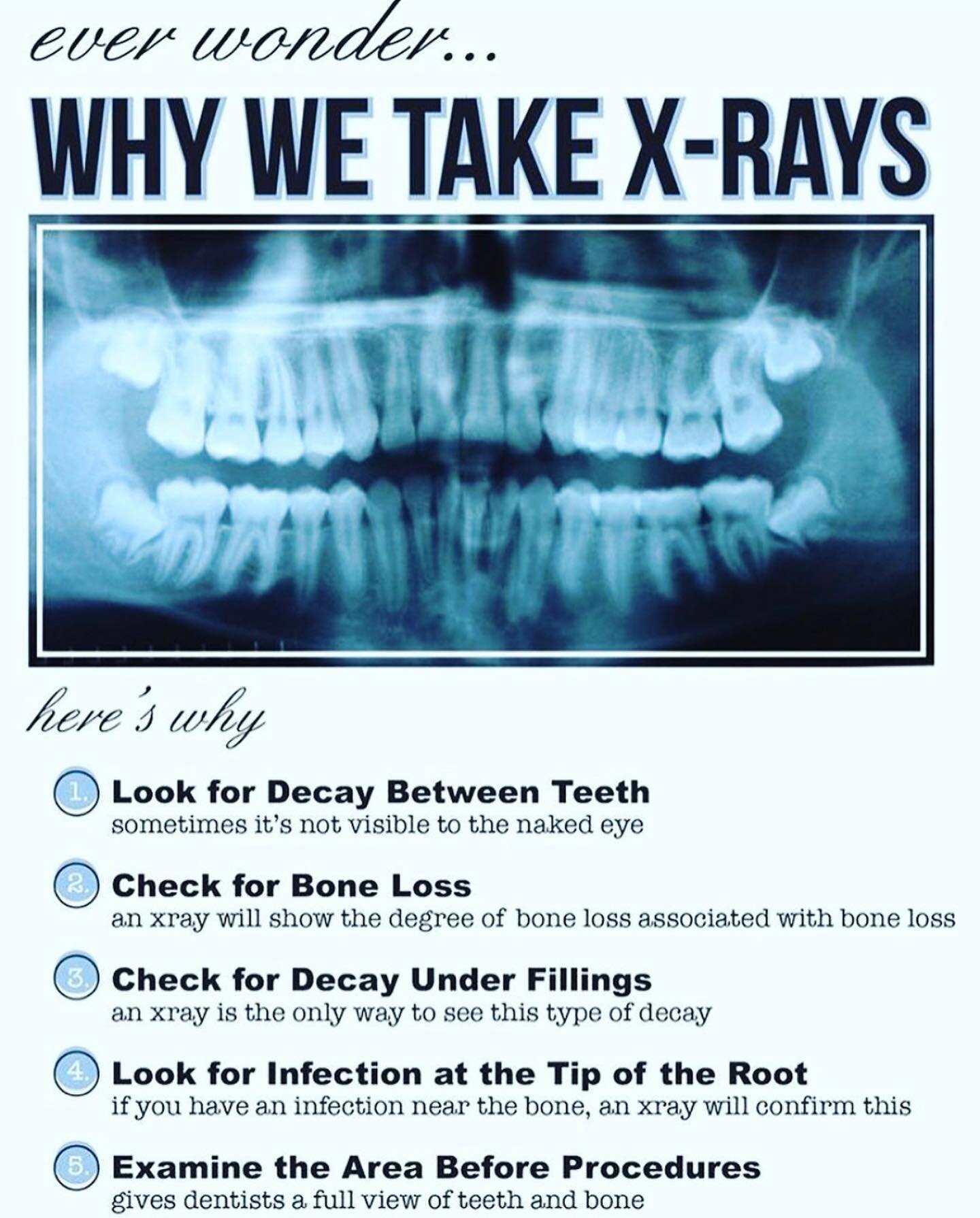 Have you ever wondered what we can see from your x-rays? 
🦷 

📍 9920 - 105 Street, Westlock,AB 
📱 780.349.5260
💻 www.westlockdental.com

#westlockdentist #dentalcare #oralhealth #westlock #dentist #dentalteam #barrhead