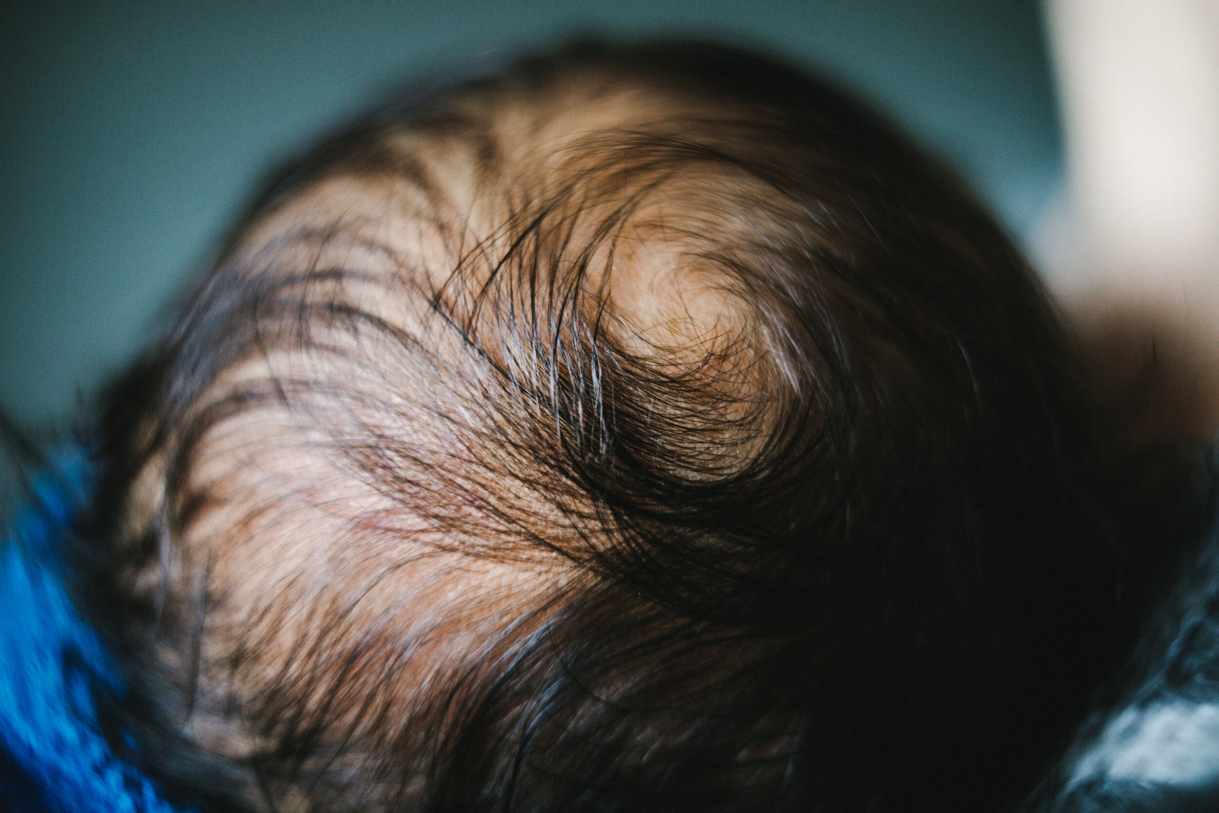 newborn-baby-hair