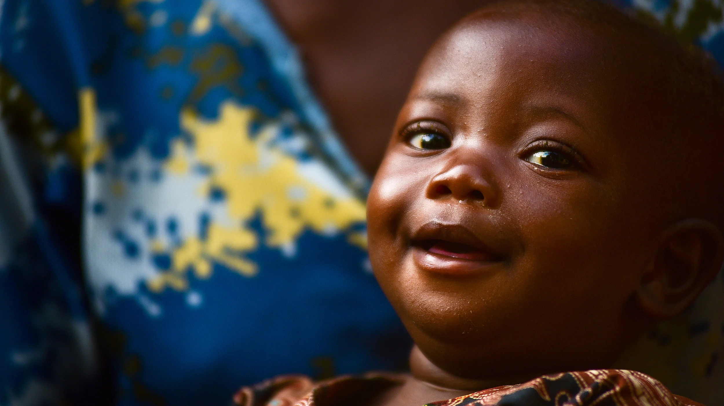 How Malnutrition Affects Cognitive Development in Children Under Two
