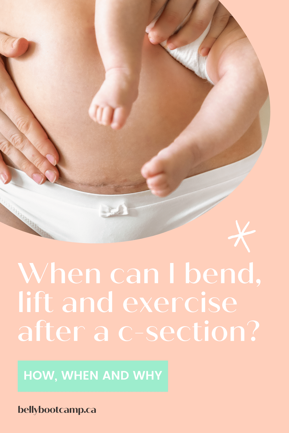 pix Internal Bleeding After C Section lift things after a c section
