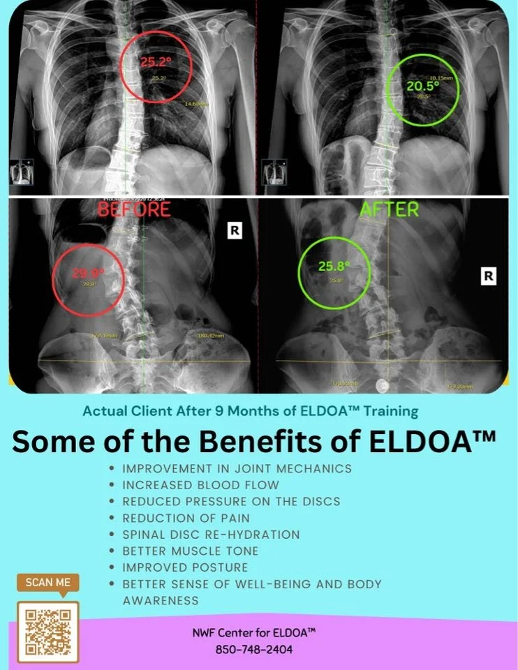 ELDOA Workshop
