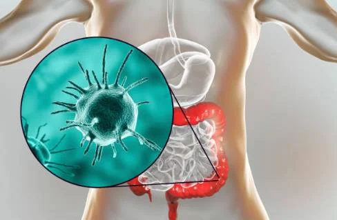 Обследование на паразитов