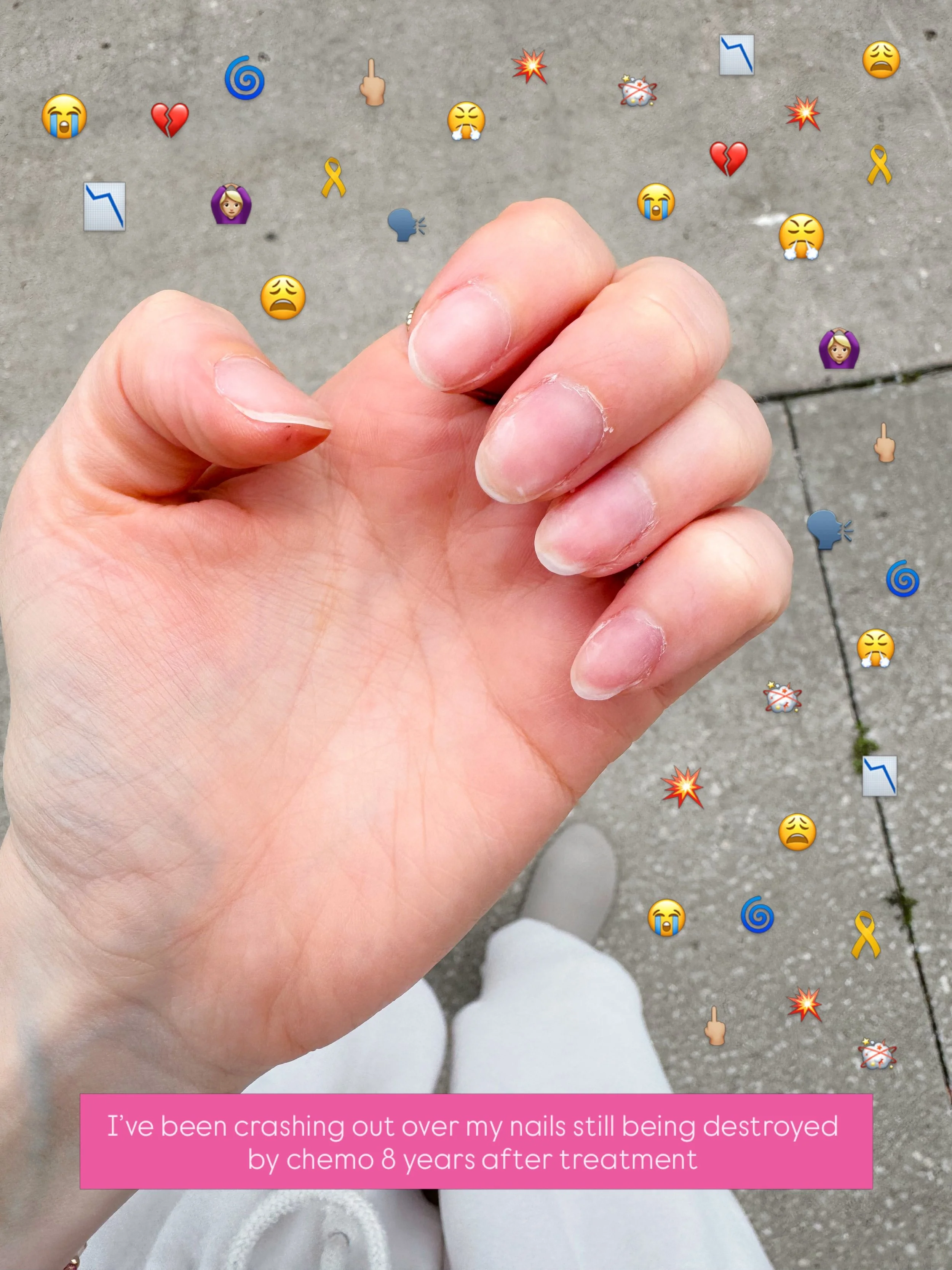 Through a series of unfortunate events, I didn&rsquo;t have my nails done for a few days + I forgot how painful it is to go au natural&hellip; truly had me crashing out over STILL dealing with cancer side effects close to a decade out 😩

My nails ar