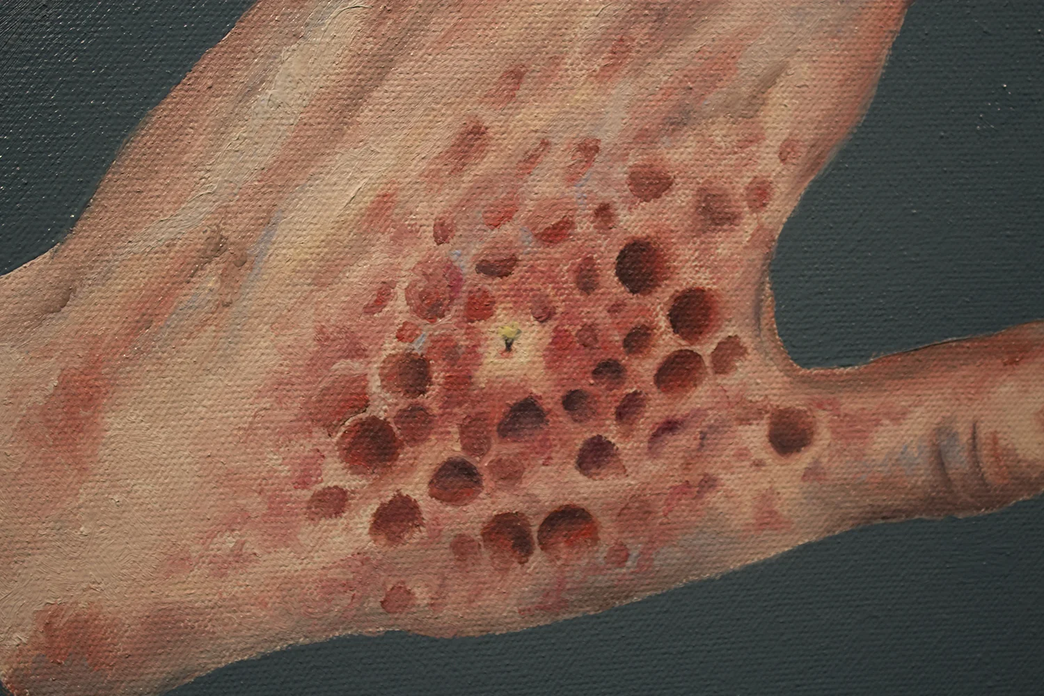 InfectuousSting.detail1.jpg