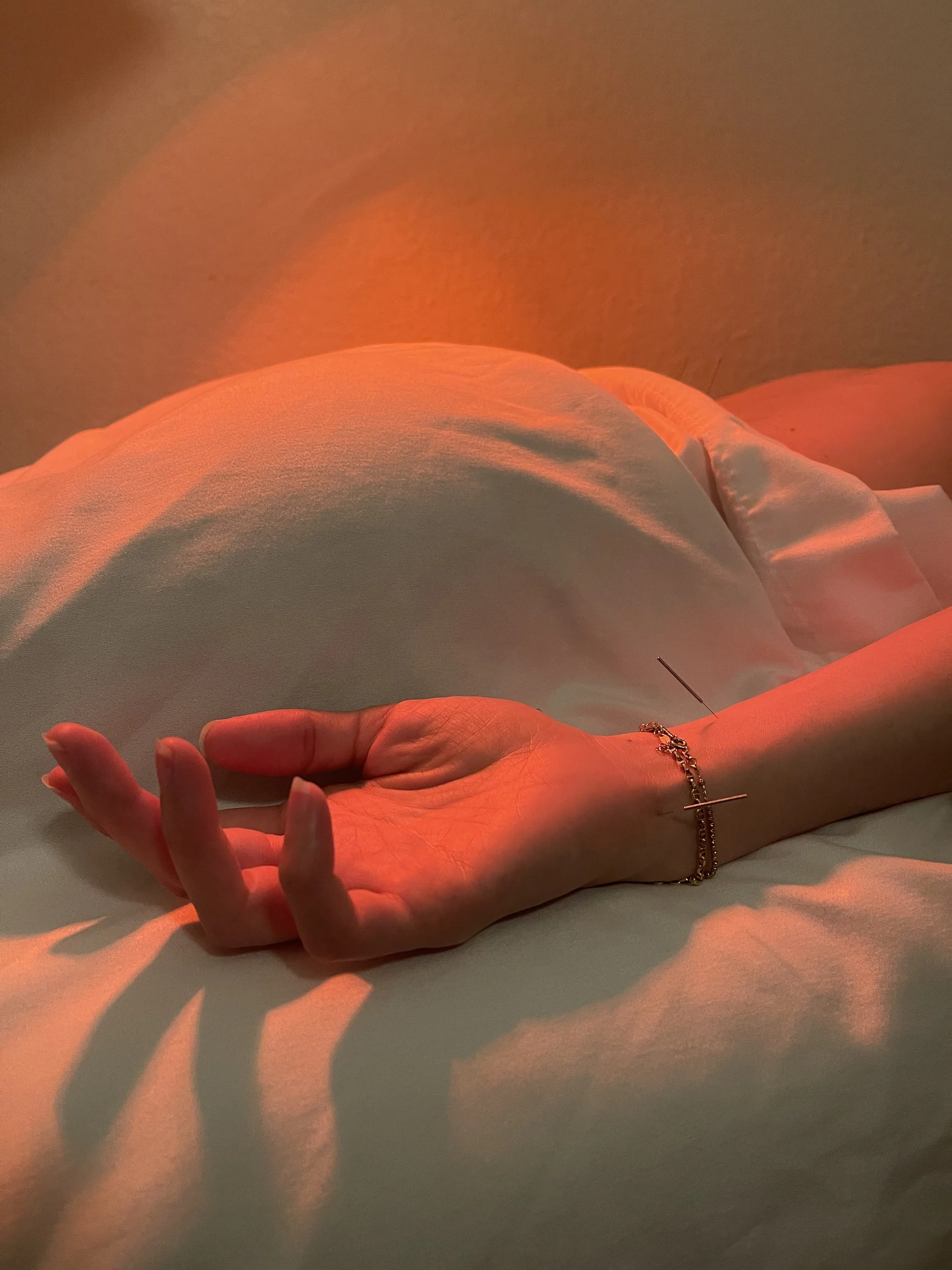The Power of The Acupuncture Needle