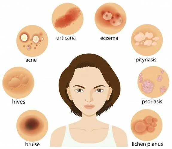 Identifying Common Skin Rashes 1200x2447