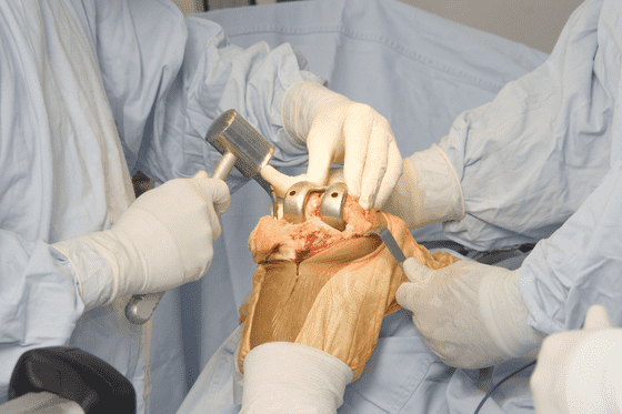 Who are orthopaedic surgeons and what do they do? — Medipulse: Best Private Hospital in Jodhpur
