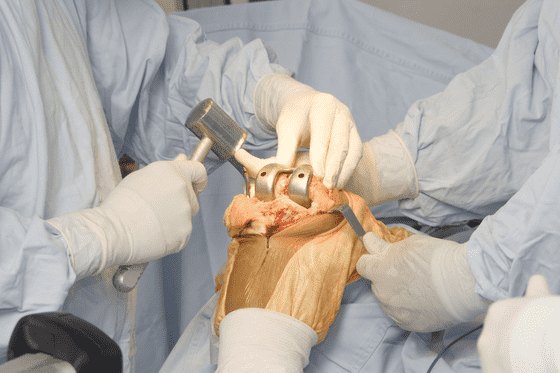Axis Spine And Orthopedics