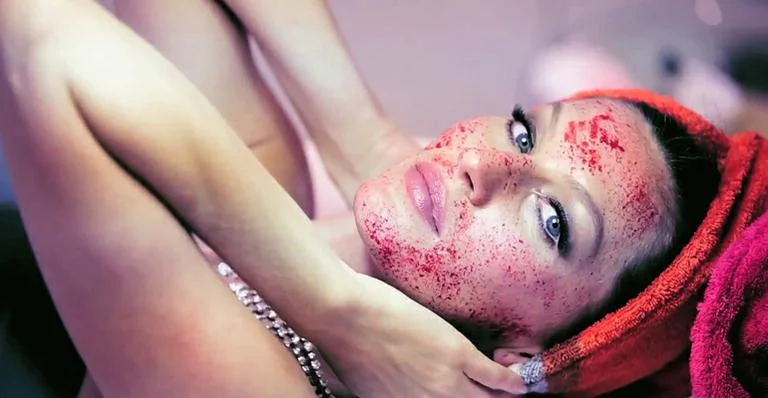 Vampire Facelift - Gisele Bündchen