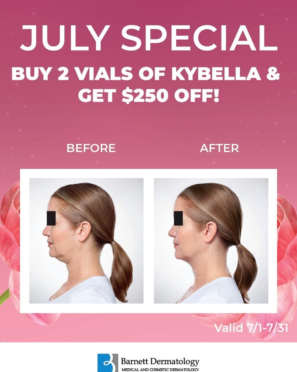 ✨Kybella ✨

Say goodbye to your double chin and hello to Kybella 😍

Kybella is an injectable that melts away stubborn chin fat. 

Q: How long does it last? 
A: This is a permanent treatment.

Q: What is the down time?
A: You will be swollen around t