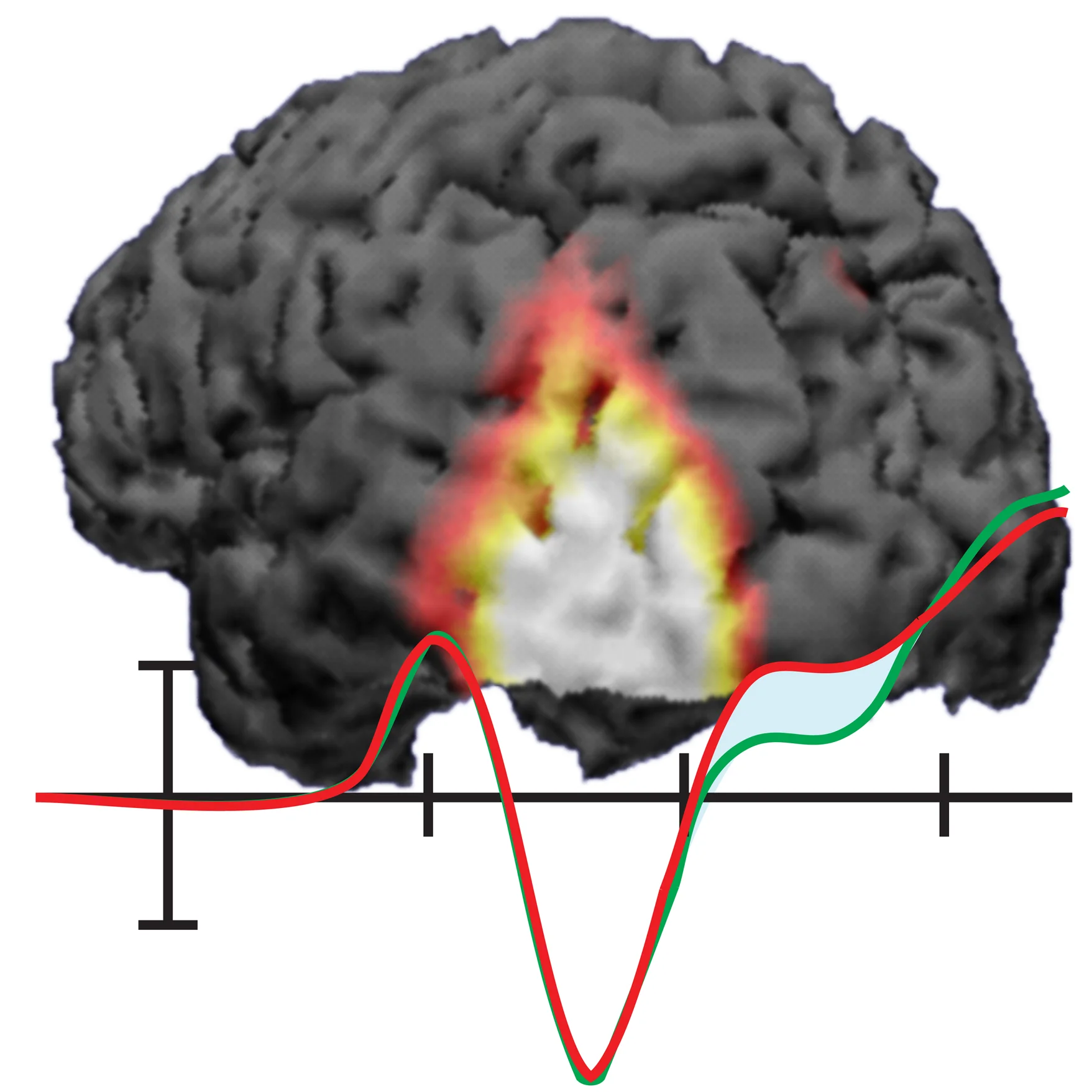 N2pc CSD+Waveform.jpg