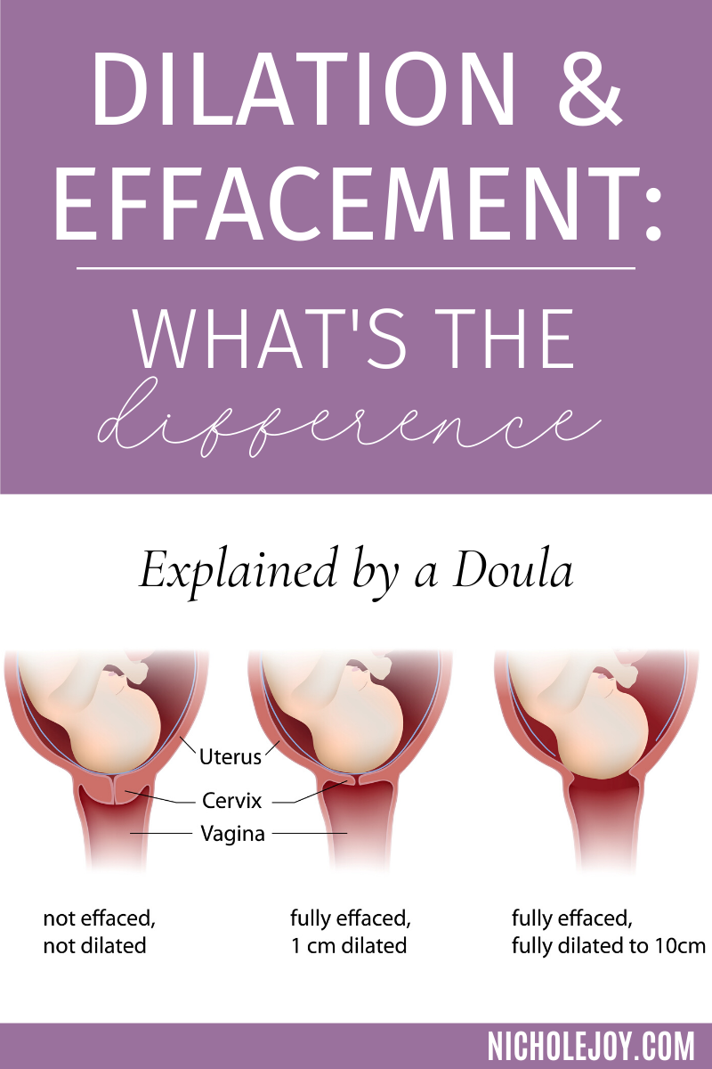 Dilation &amp; Effacement: What's the Difference?