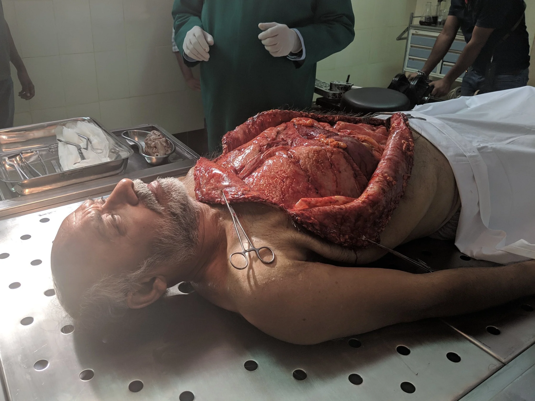 autopsy+prosthetic.jpg