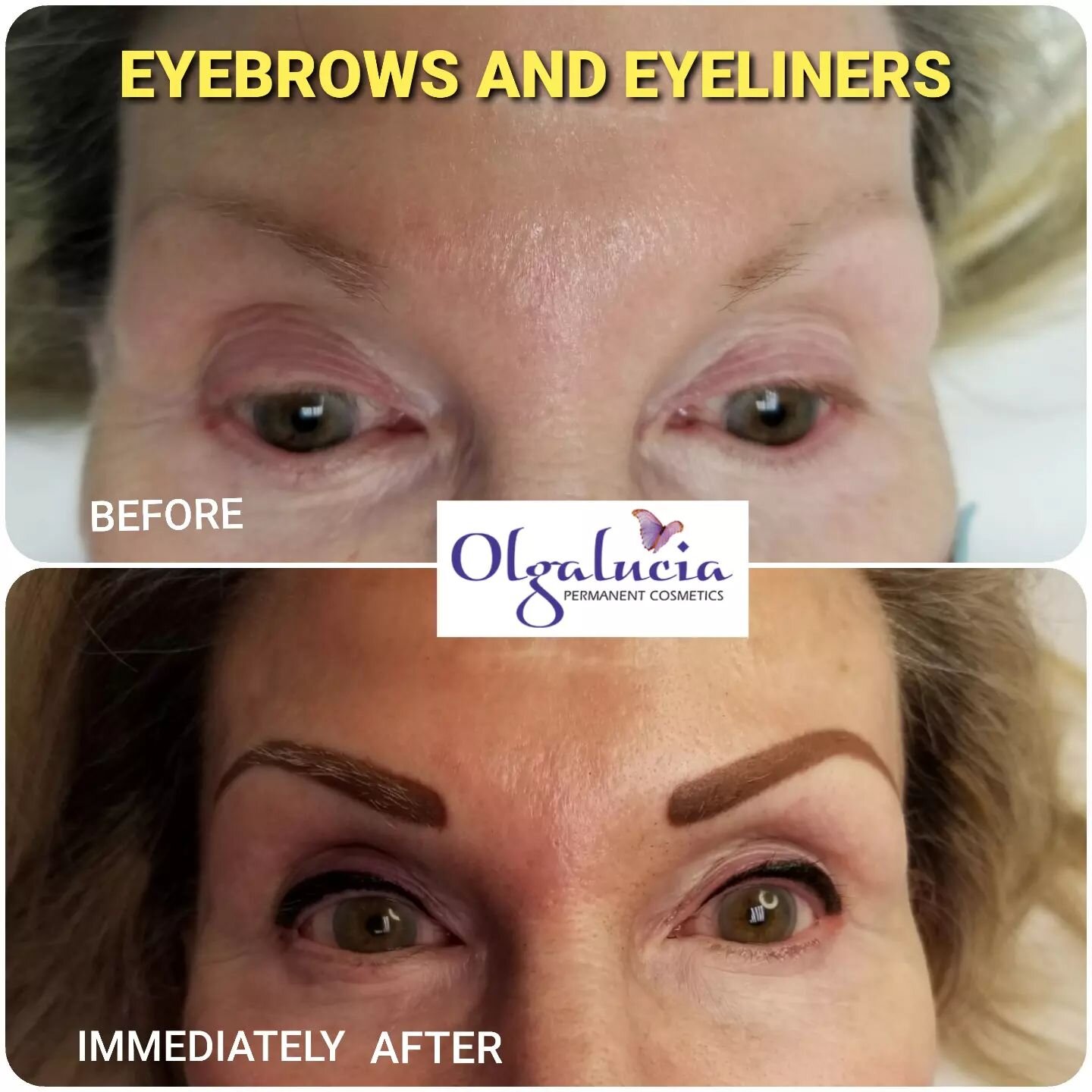 Permanent EYEBROWS and EYELINERS immediately done. Here it shows the improvement and enhancement of the eyes. After healed it will look softer and lighter.
#eyelinertattoo #eyeliner #eyebrows #permanentmakeup #permanentcosmetics #permanenteyebrows #y
