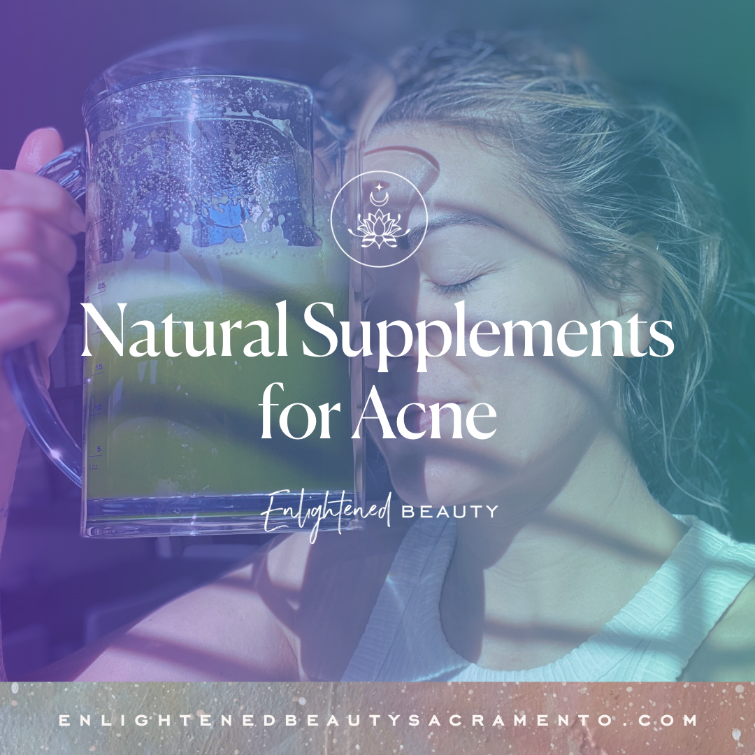 Natural Supplements for Acne