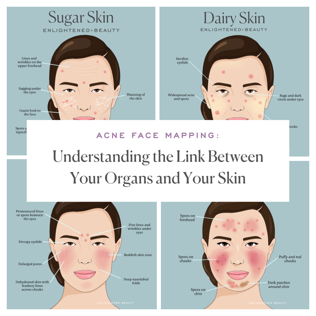 Acne Face Mapping: Understanding the Link Between Your Organs and Your Skin