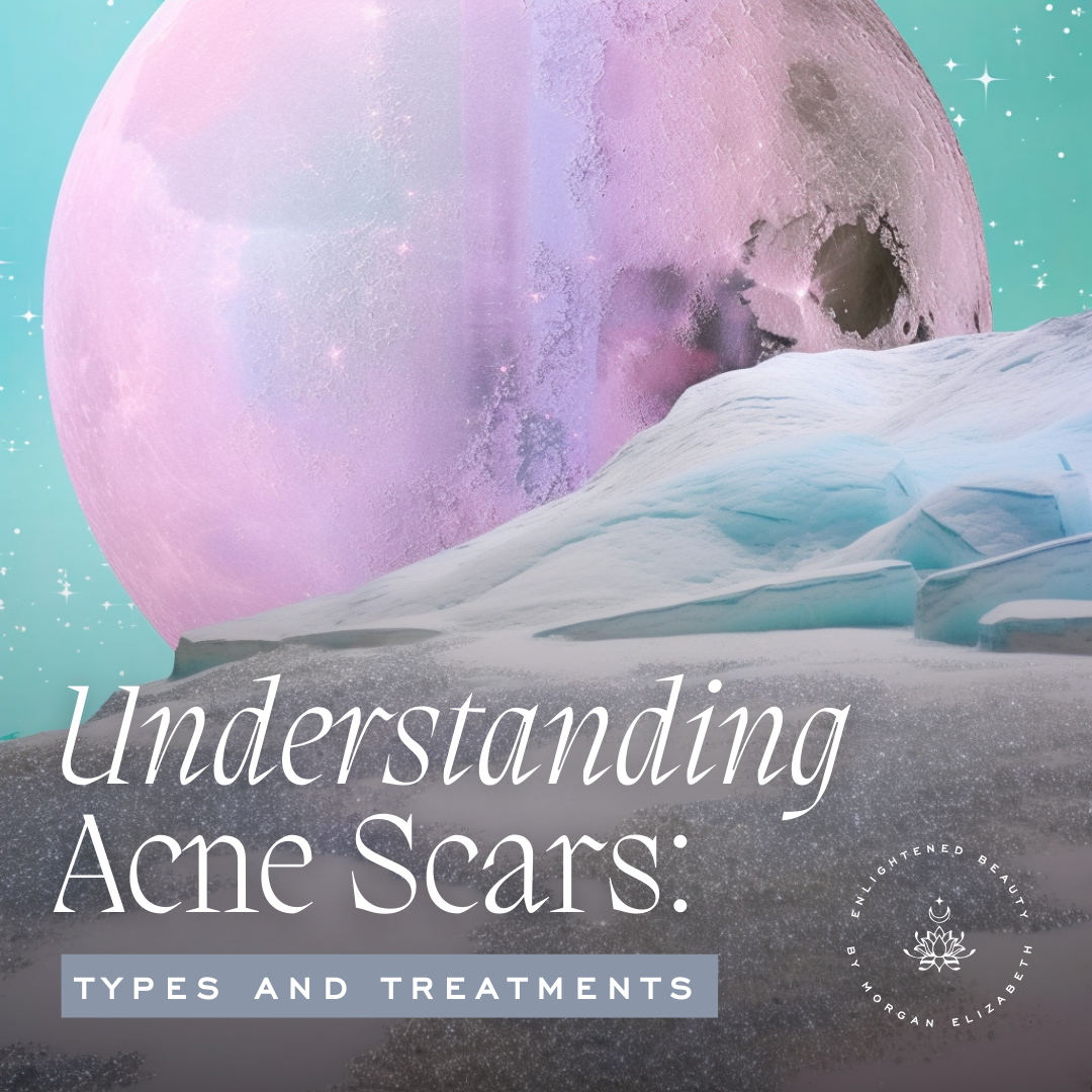 Understanding Acne Scars: Types and Treatments
