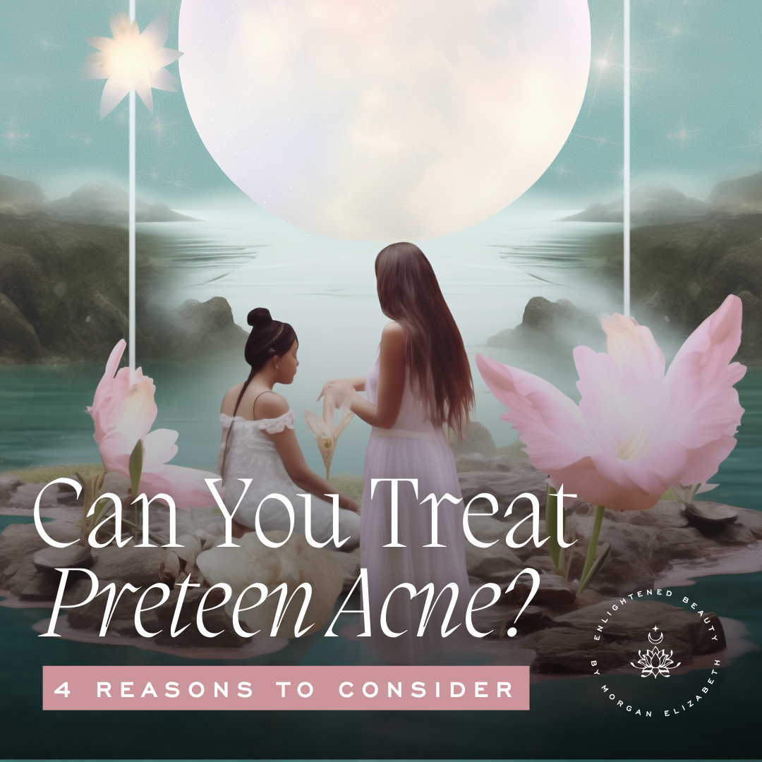 Can You Treat Puberty Acne? 4 Reasons To Start Your Preteen's Treatment Sooner