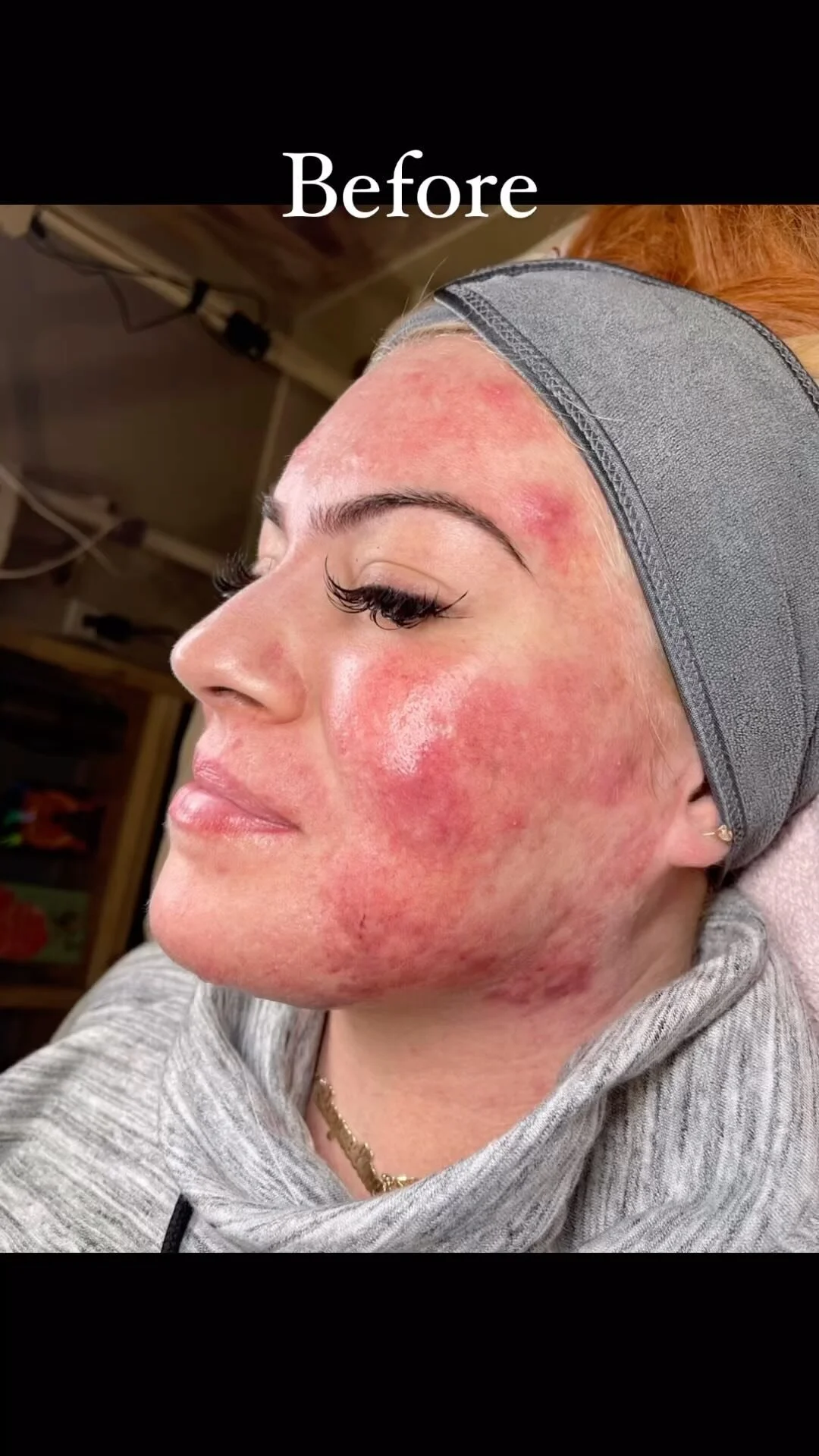 skin-care-services-sacramento-esthetician-enlightened-beauty-by