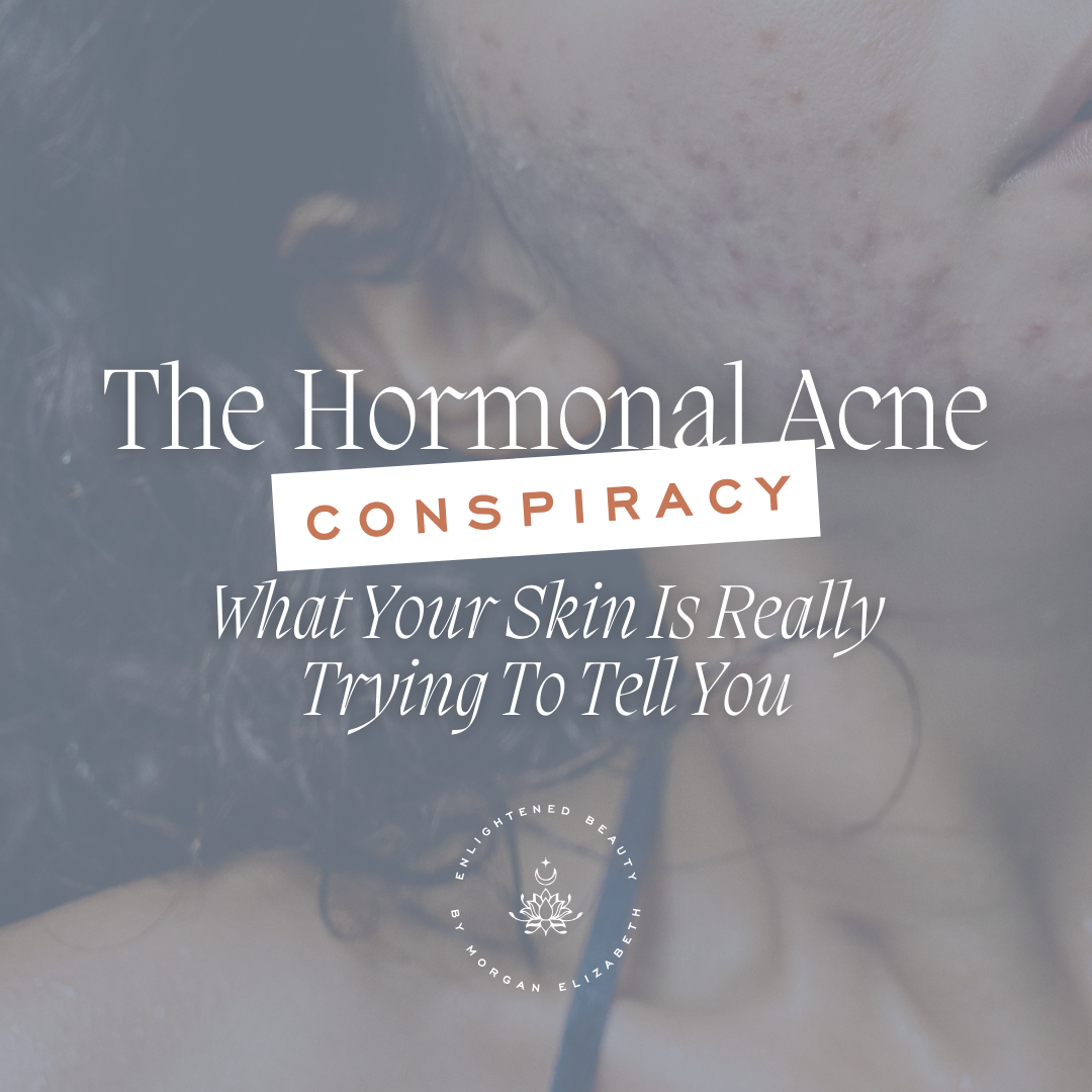 What Causes Hormonal Acne: Your Questions Answered
