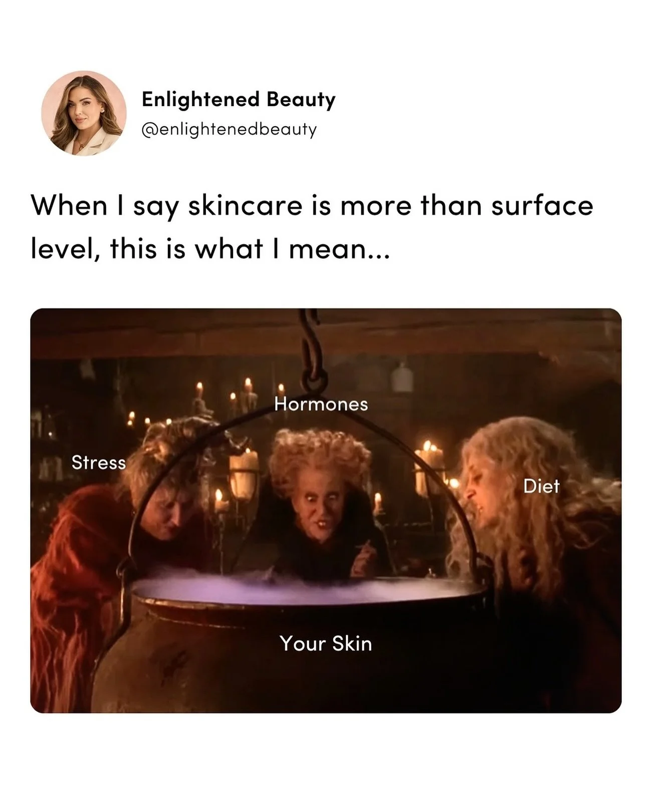 Has your acne put a spell on your skin? 🧙🏻&zwj;♀️ 

Let us break it for you 🪄 

📍 Enlightened Beauty
Sacramento + Granite Bay CA
📱 916 365 7958
💻 EnlightenedBeautySacramento.com