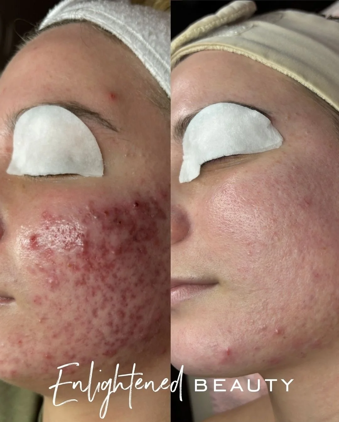 With all due respect&hellip; 💁🏻&zwj;♀️

If you are not scheduling with Enlightened Beauty, like why, &amp; what are you doing instead?!? 😏🤷🏻&zwj;♀️

I created the protocol from scratch, I teach the protocol, &amp; the world is better for it 💧 
