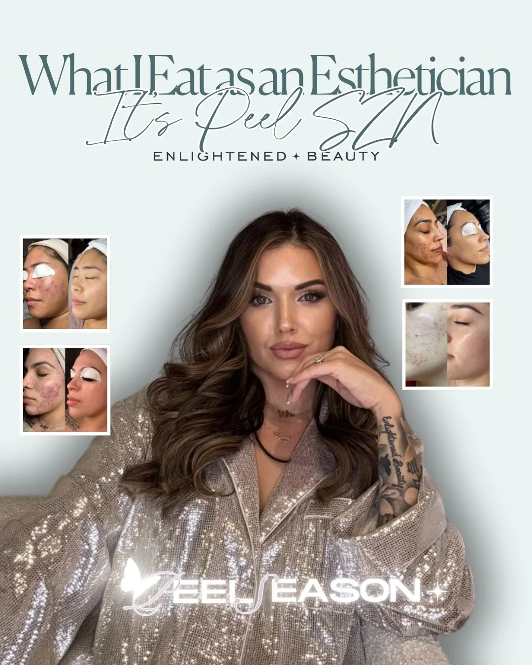 I&rsquo;m full&hellip; 😮&zwj;💨 🍽️ 

Sacramento&rsquo;s Leading Acne Esthetician 💁🏻&zwj;♀️

📍 Enlightened Beauty
Sacramento + Granite Bay CA
📱 916 365 7958
💻 EnlightenedBeautySacramento.com