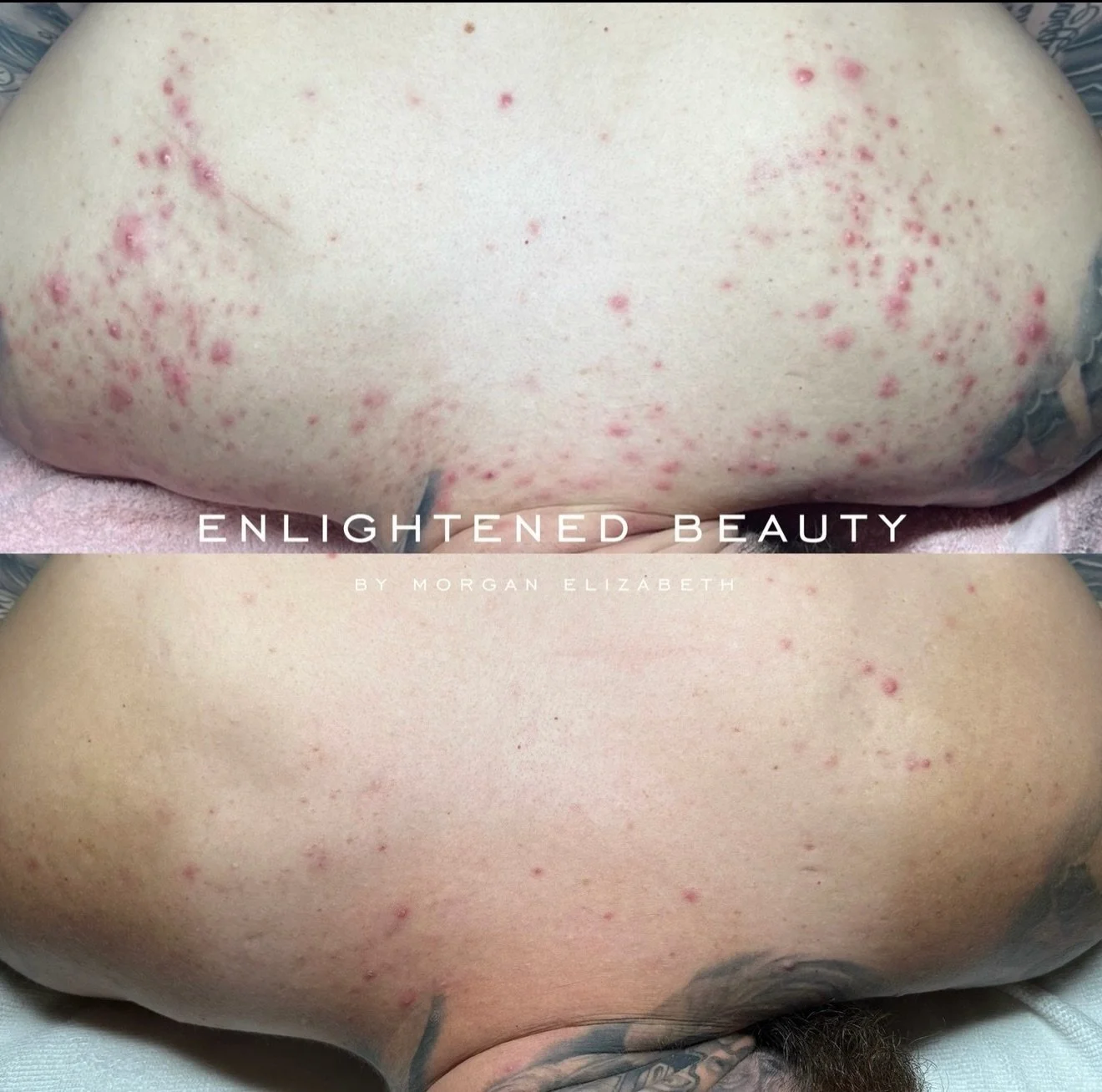 &amp; then one day you decide to change 🪞 (w/ enlightened beauty)

I got your back 💁🏻&zwj;♀️

📍 Enlightened Beauty
Sacramento CA
📱 916 365 7958
💻 EnlightenedBeautySacramento.com