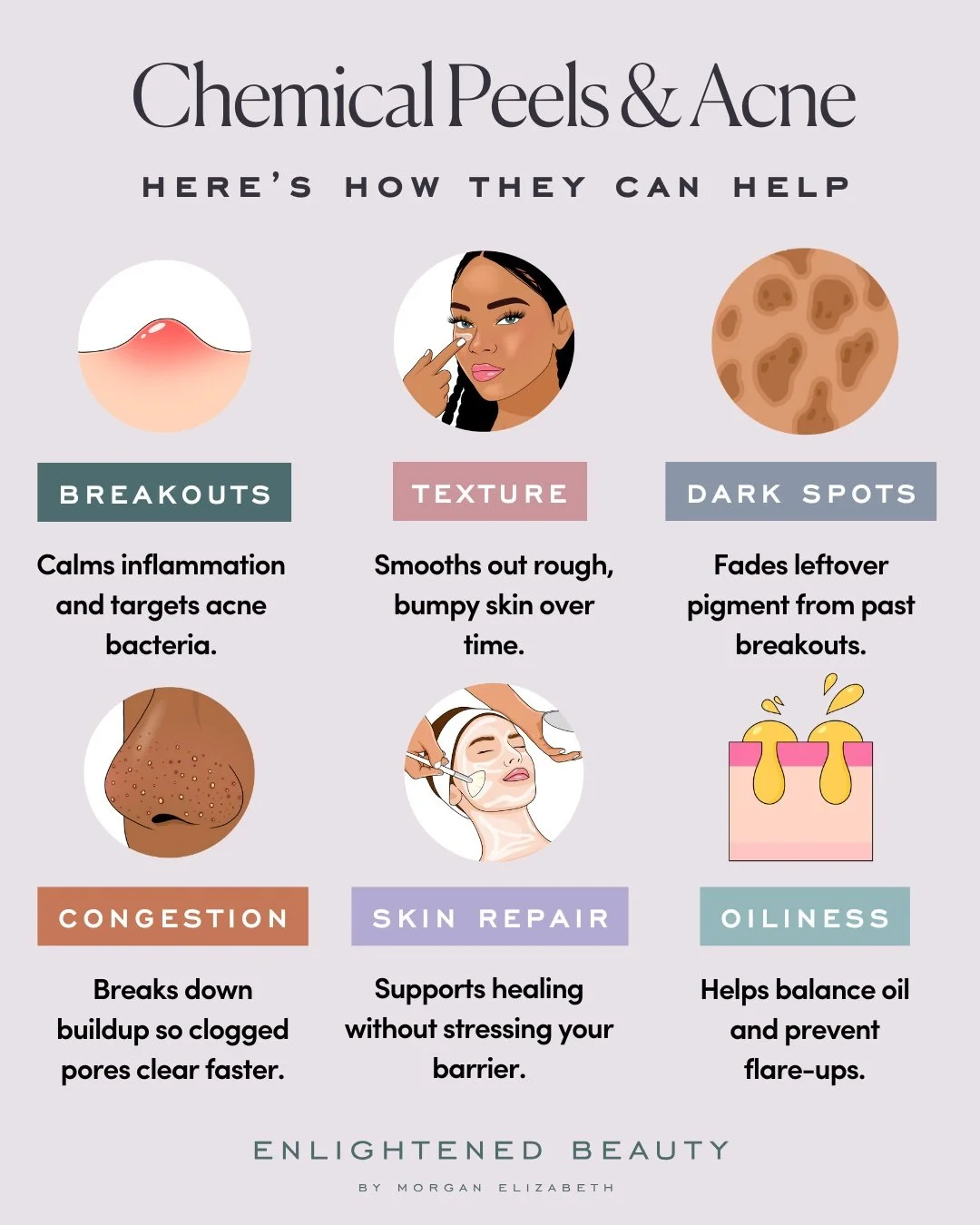 Your skin isn&rsquo;t a problem to fix. It&rsquo;s a system to support.

When acne keeps showing up, it&rsquo;s usually because the skin needs help shedding, regulating, and rebuilding.

There is a way forward that doesn&rsquo;t rely on harsh treatme