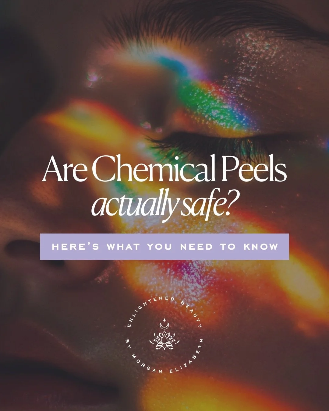 Chemical peels aren&rsquo;t the problem...
How they&rsquo;re done is.

A lot of people have had bad experiences with peels, and it usually comes down to this:

No prep. No barrier support. No real plan.
Just putting acid on compromised skin and hopin