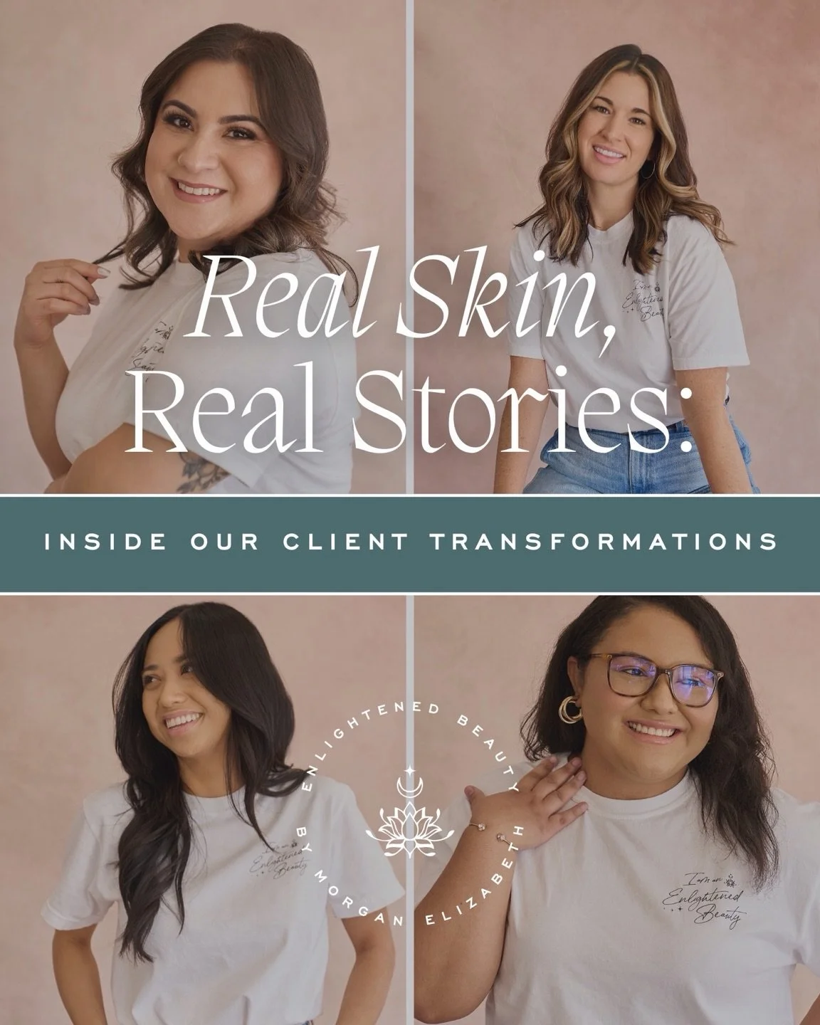 Spring 🌼 is here 💖

Real skin. Real stories. Real healing 🤍

These women didn&rsquo;t just trust me with their skin&hellip; they trusted me through seasons of their lives. Stress, hormones, life changes, inconsistency, growth l&hellip; we&rsquo;ve