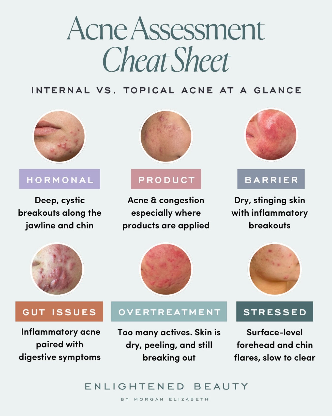 Another one for my estheticians, if the protocol is right but the skin isn&rsquo;t responding, the issue might not be the protocol...

Internal and topical acne can look identical, but they need completely different approaches. Until you identify whi