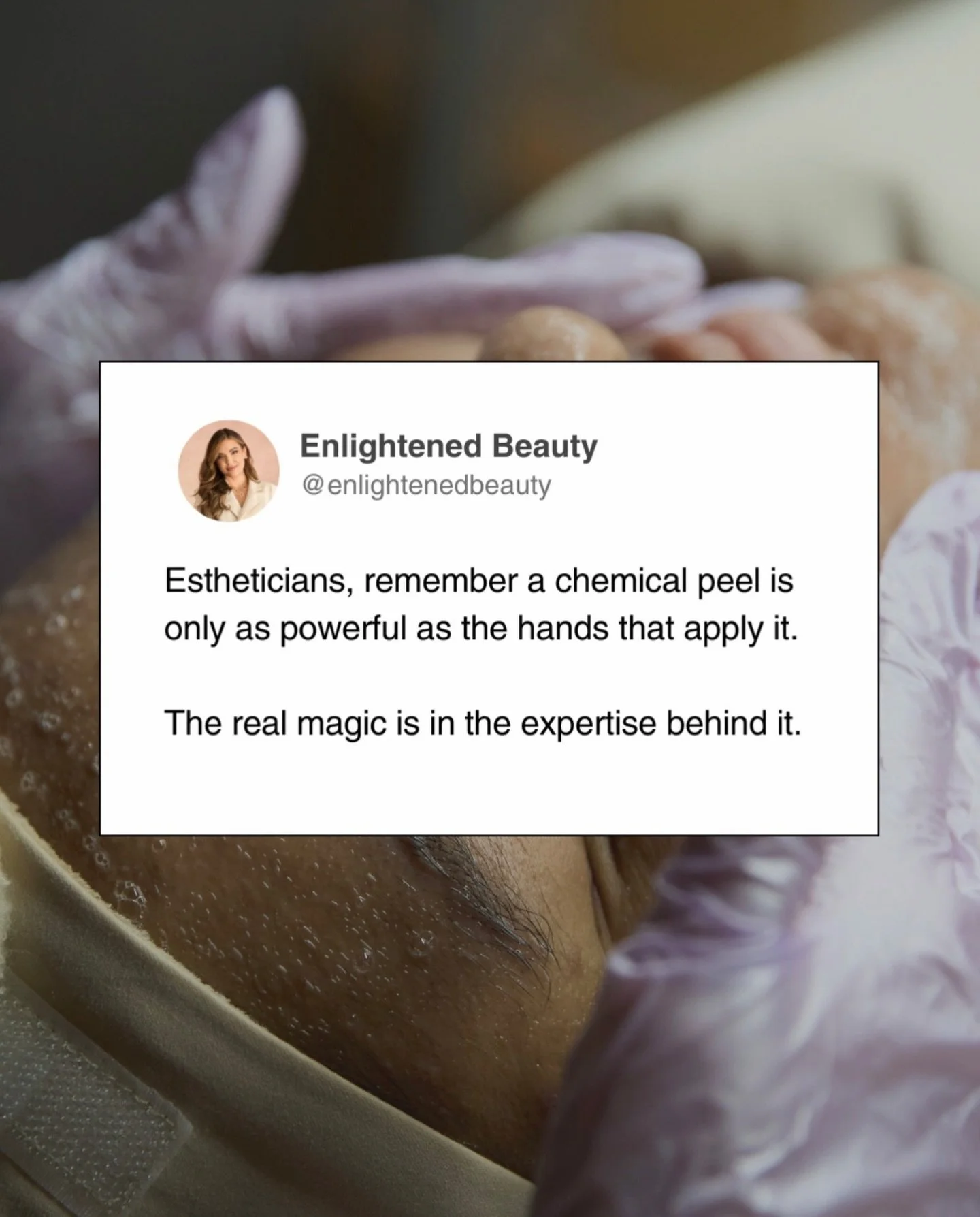 Estheticians, this is something I think about constantly.

We learn the what - the products, the protocols, the peel percentages. Most of us were never taught the WHY behind the decisions we&rsquo;re making on someone&rsquo;s skin.

🤔Why this acid o