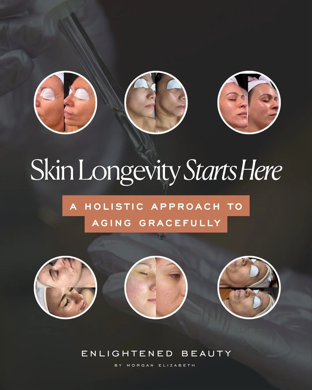 Somewhere in your 30s, your skin starts asking different questions than it did in your 20s...
⠀⠀⠀⠀⠀⠀⠀⠀⠀
It wants more hydration 💦 
It wants you to protect your barrier 🛡️
It wants you to sleep, manage stress, and stop over-exfoliating ⚖️
It wants t