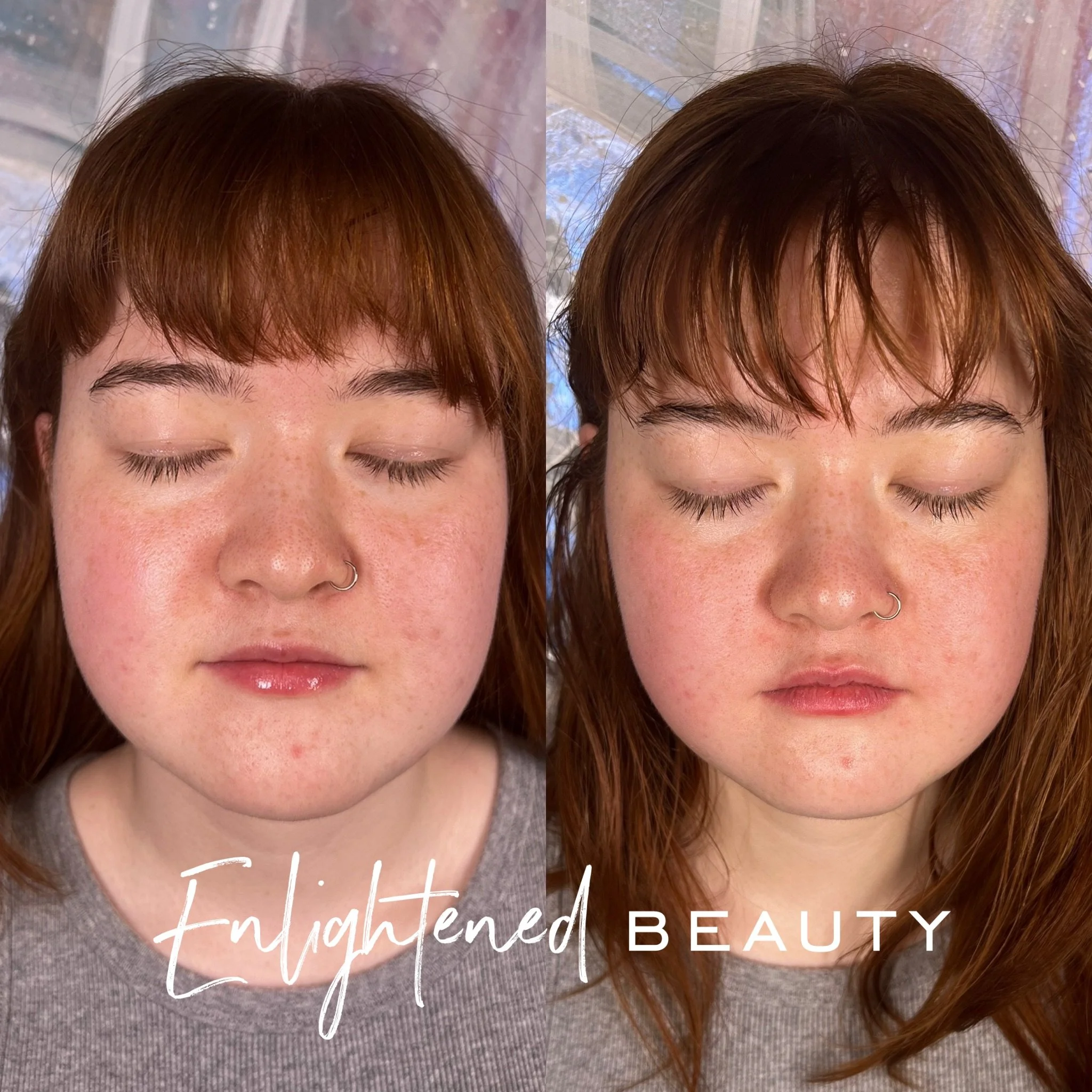 Enlightened Facial Buccal Massage before and after, shows reduced inflammation in the womans face