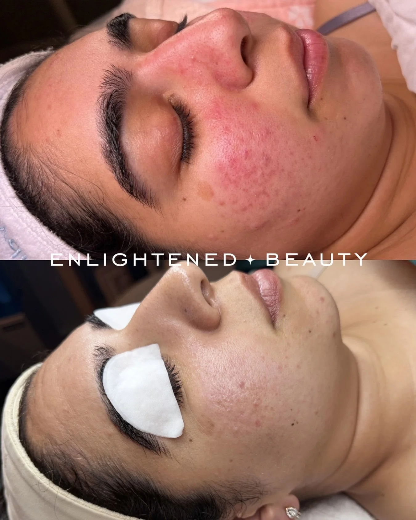 One of the most beautiful things I&rsquo;ve witnessed over the last 13+ years isn&rsquo;t just skin transformation&hellip; it&rsquo;s life transformation.

I&rsquo;ve watched clients come to me hiding behind makeup, avoiding photos, canceling plans, 