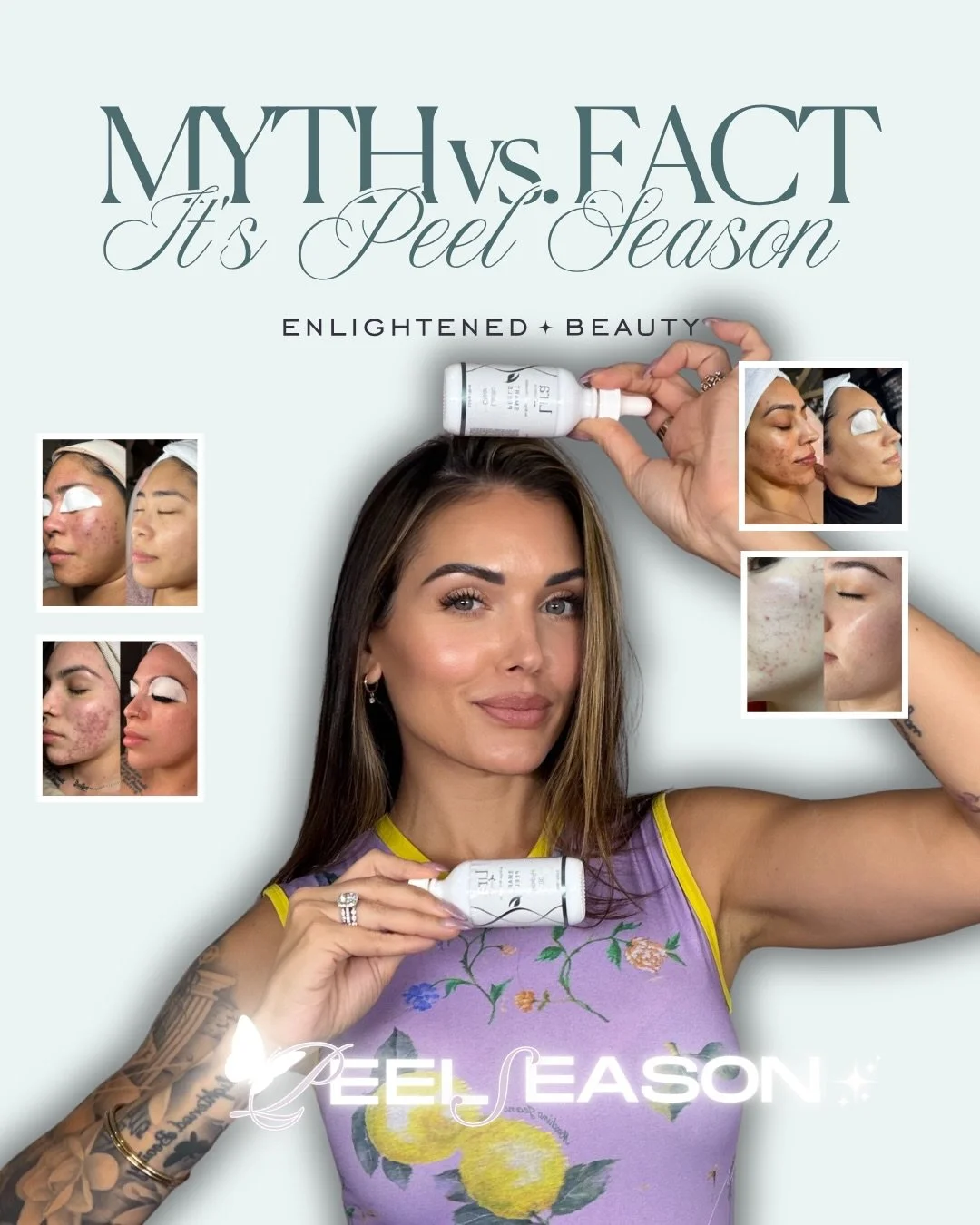 It&rsquo;s that time babe! #PeelSzn 🐍✨😘

Comment &ldquo;book&rdquo; below 👇🏼 for your link 🔗 babe 😍