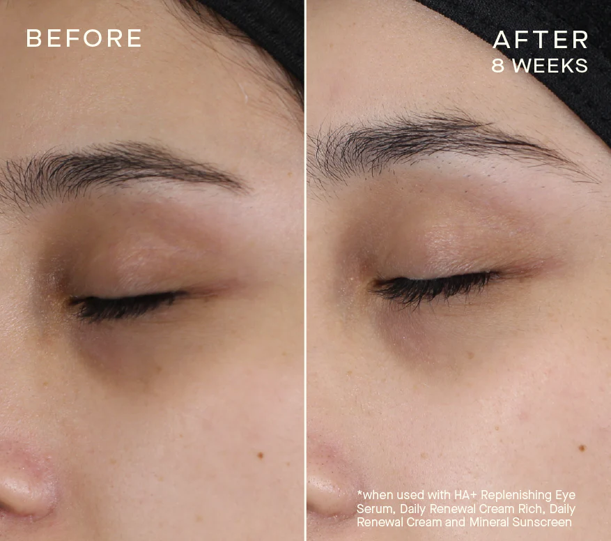 HA_SERUM004_BA_876x776_1_8e1d6042-de0b-4594-864e-e3ab3ad8258e_876x776_crop_center@2x.png