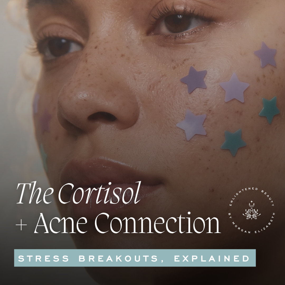 Cortisol and Acne What's Actually Happening Inside Your Skin When You're Stressed - blog cover features woman with star shaped pimple patches on her face
