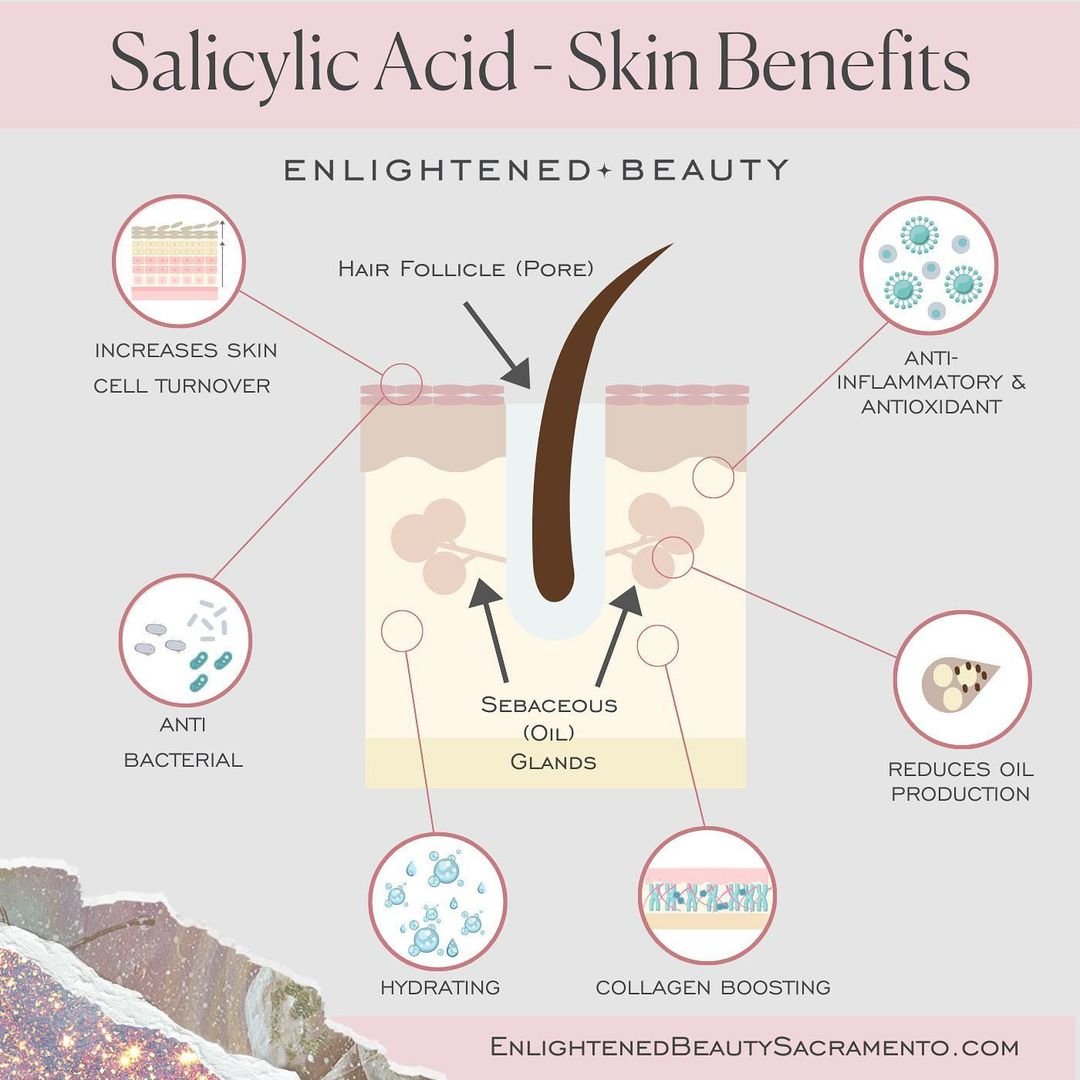 Benzoyl Peroxide Vs Salicylic Acid Wash – JZQUW