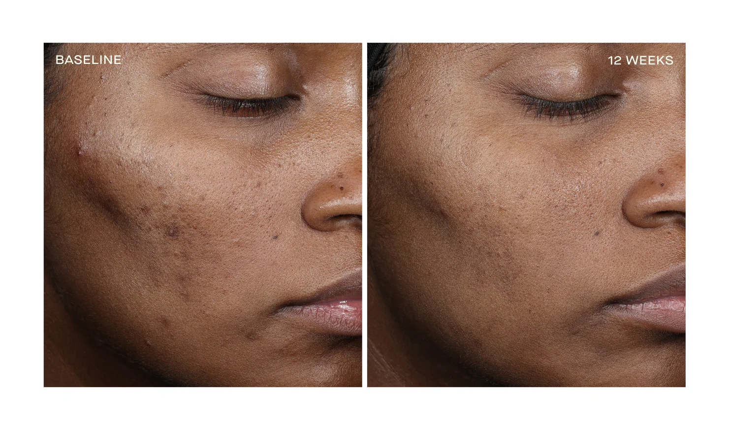 Ourself_BeforeAndAfters_8_C_876x776_crop_center@2x.png