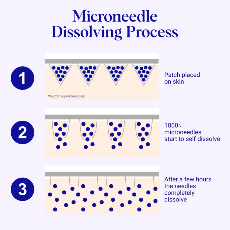 Microneedles.png