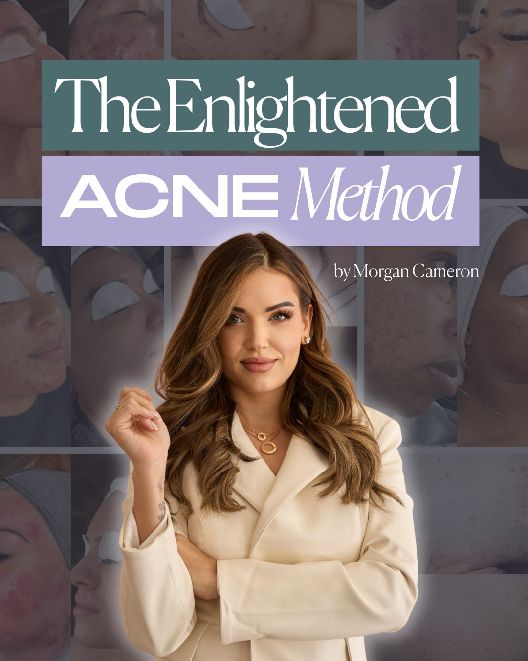 The Enlightened Acne Method
