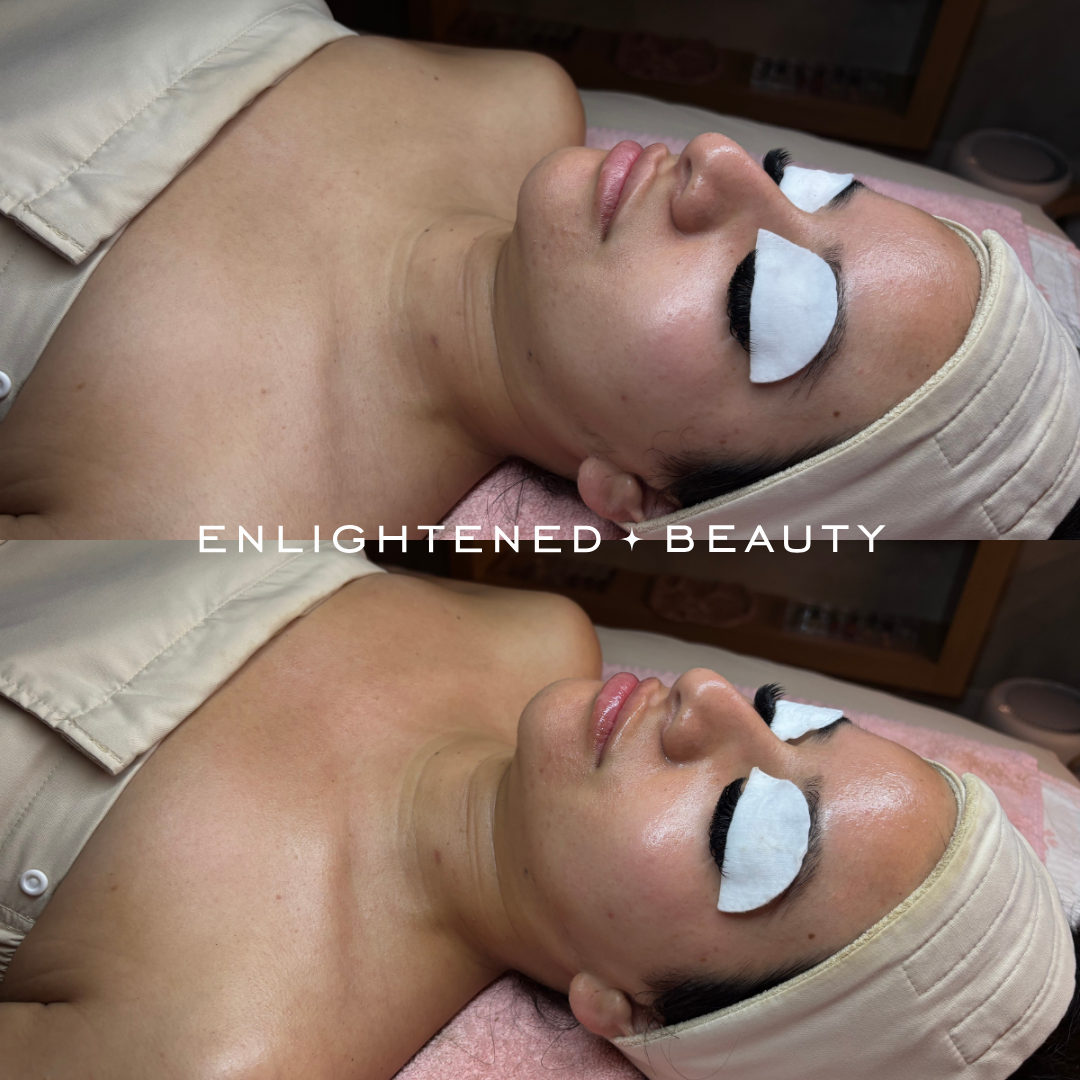 Glacial Treatments before and after, shows skin going from dull to glowy