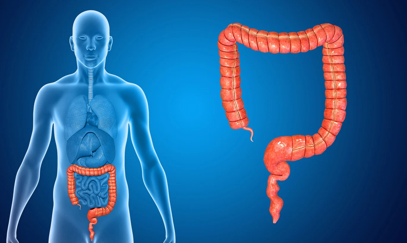 Colon_1.jpg