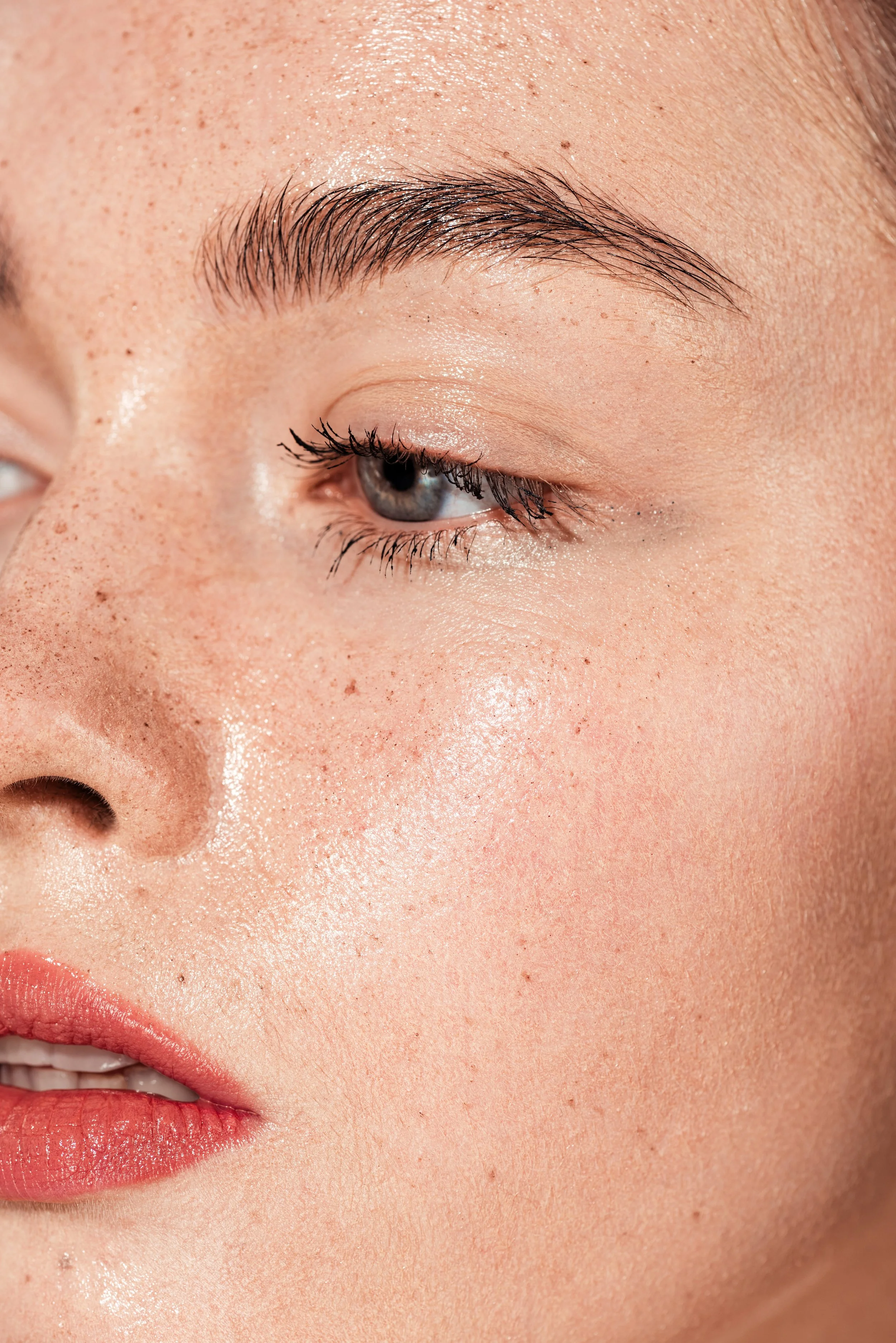 Your Essential Guide to Pigmentation and Melasma
